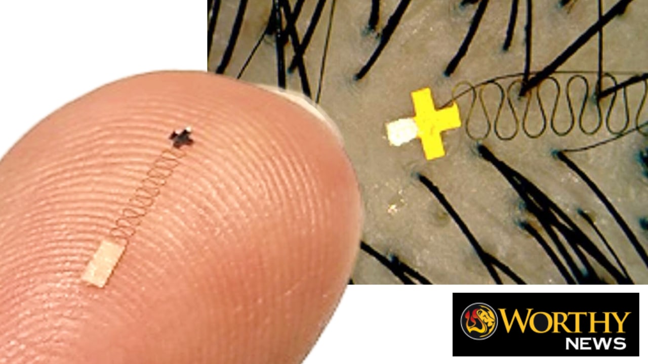 The Mark of the Beast? The Tech Is Already Here 11 ga tech microchip hair folicle mark beast worthy christian news